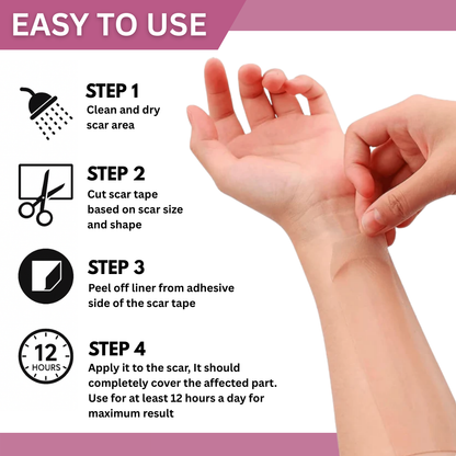Smooth Patch™ Silicone Scar Sheets