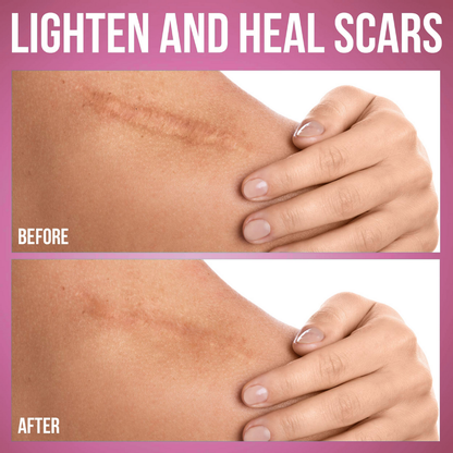 Smooth Patch™ Silicone Scar Sheets